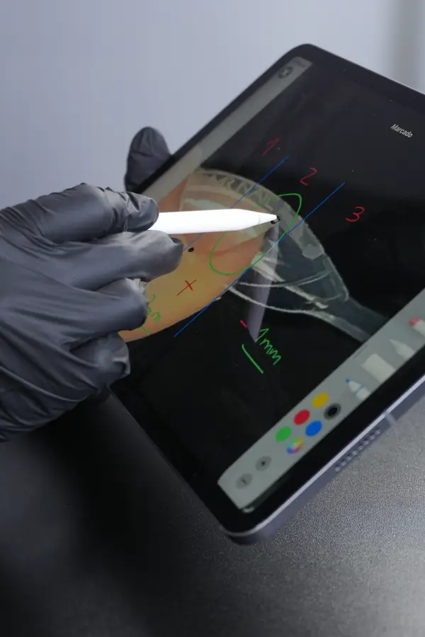 Clase online de VK Studio: análisis de uña en tablet